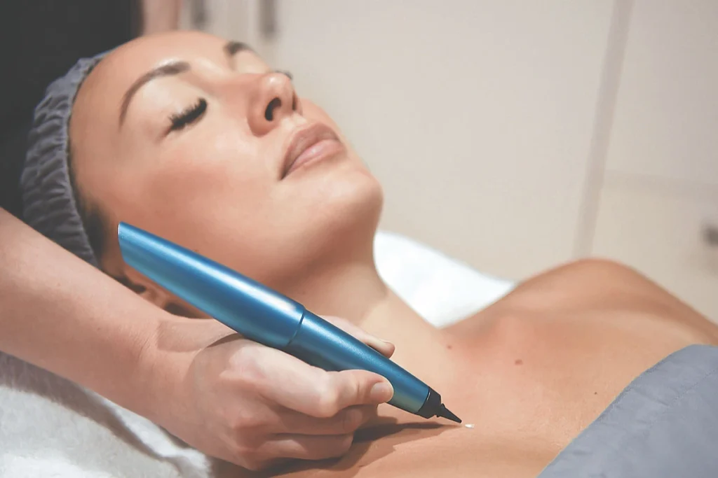 What is CryoPen Technology Worthing? Worthing